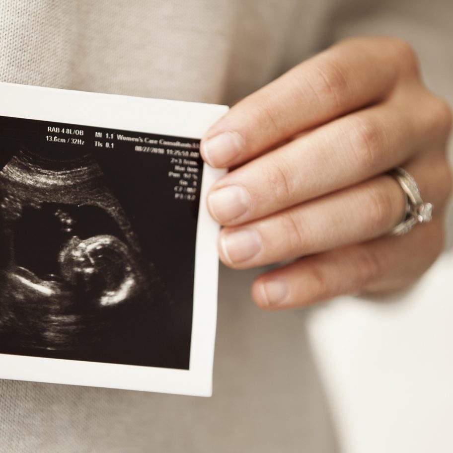 What Does It Mean to Be ‘ProLife’?